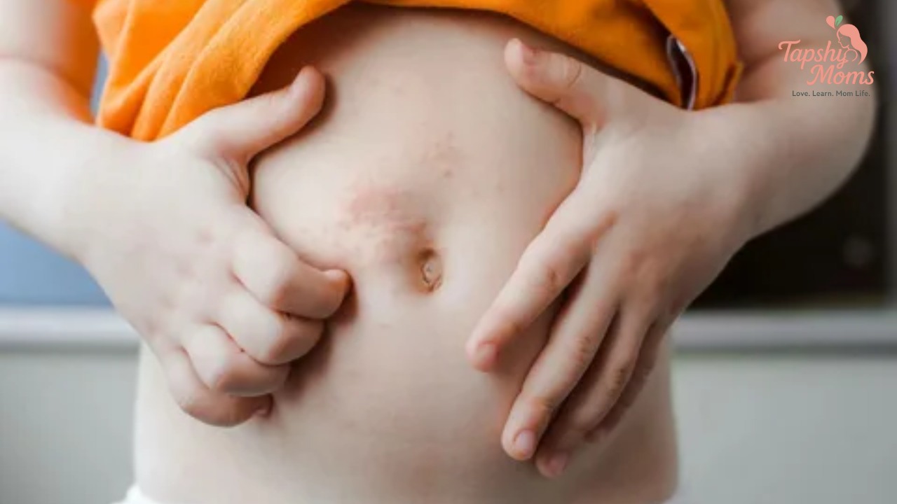 Home Remedies for Rash on Baby Body